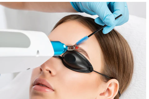 Rostro de mujer con gafas de protección negras removiéndose maquillaje permanente en Kimberly Cala Estética Profesional